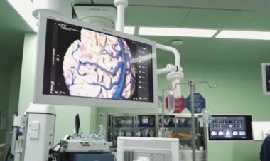 China begins trial of brain-computer implant